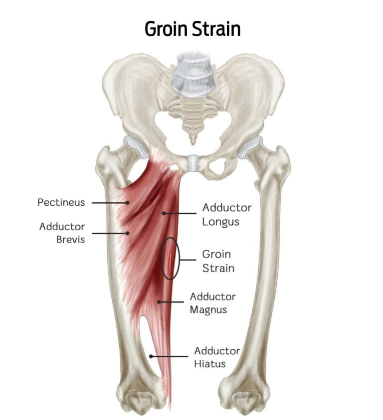 Understanding the Anatomy of Groin Muscles: A Comprehensive Guide ...